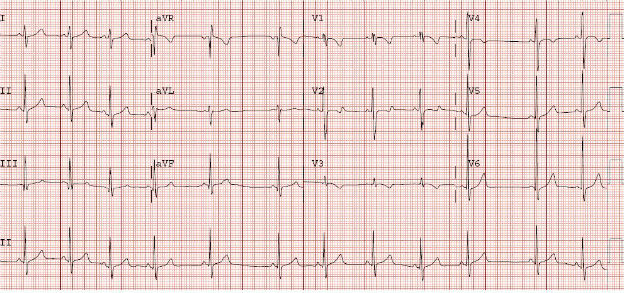 Case 2.1 fig 1