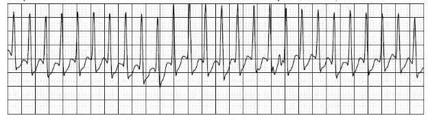 Case 2.1 fig 2