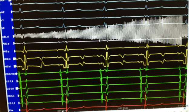 Case 2.1 fig 3