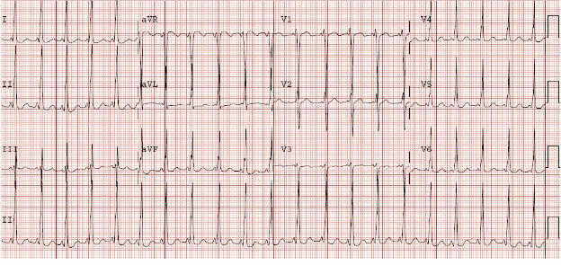 Case 2.2 fig 1