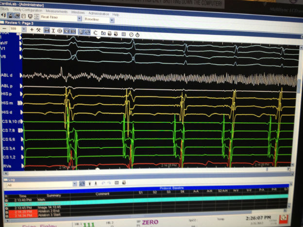 Case 2.2 fig 2