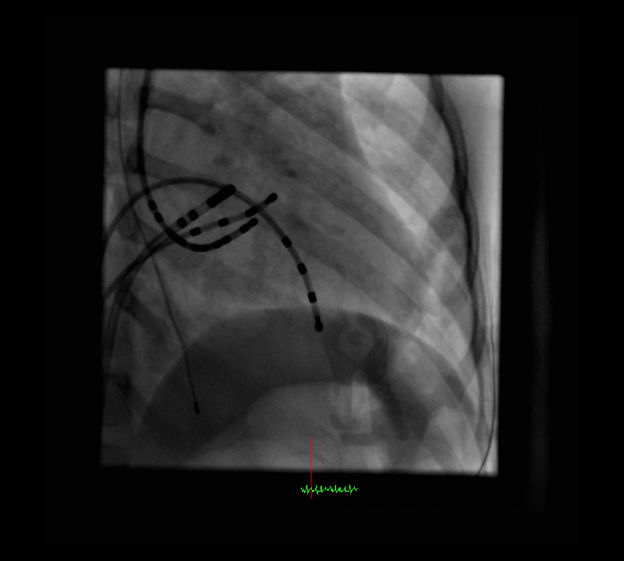 Case 2.2 fig 3