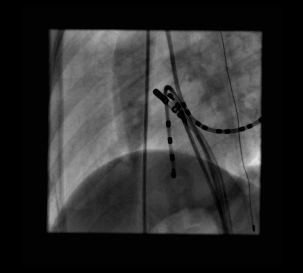 Case 2.2 fig 4