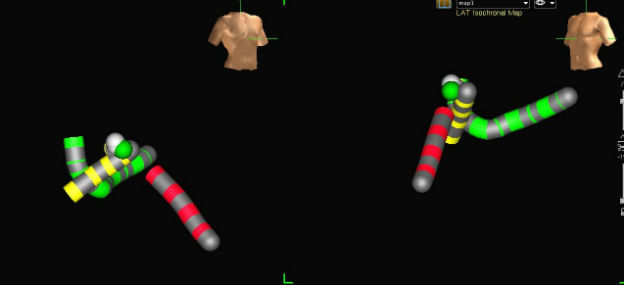 Case 2.2 fig 5
