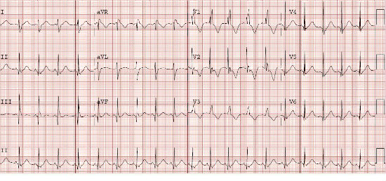 Case 2.2 fig 6