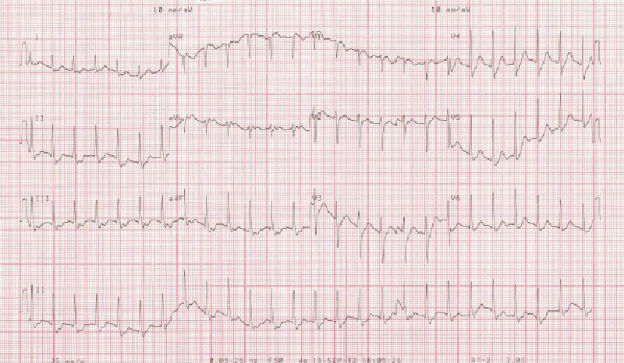 Case 4.2 fig 1A