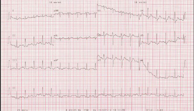 Case 4.2 fig 1B