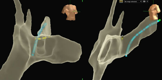 Case 4.2 fig 2A