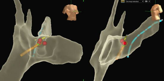 Case 4.2 fig 2B