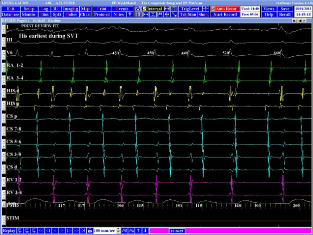 Case 4.1 fig 1A