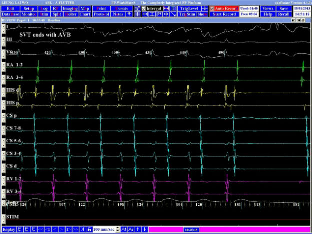 Case 4.1 fig 1B