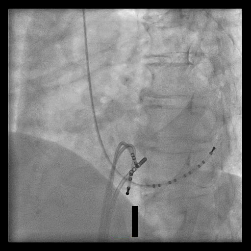 Case 4.1 fig 2A