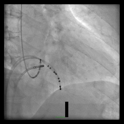Case 4.1 fig 2B