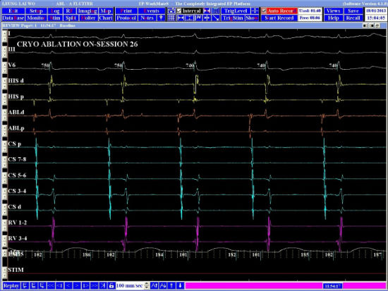 Case 4.1 fig 3