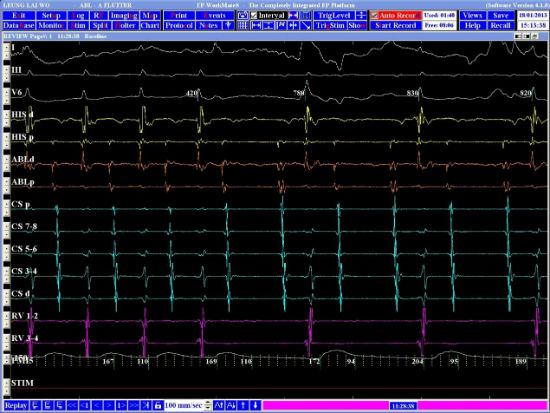 Case 4.1 fig 4