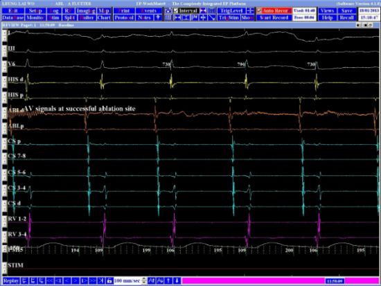 Case 4.1 fig 5A