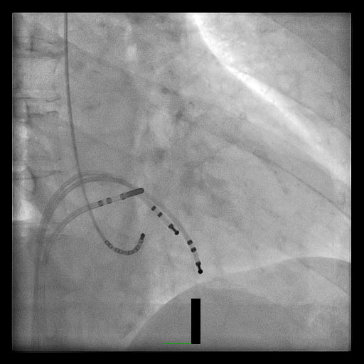 Case 4.1 fig 5B