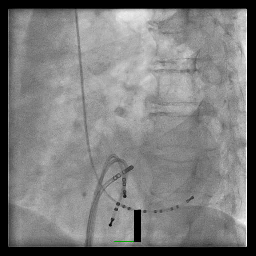 Case 4.1 fig 5C