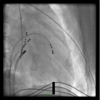 Case 8.1 fig 2A