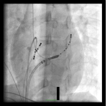 Case 8.1 fig 2B