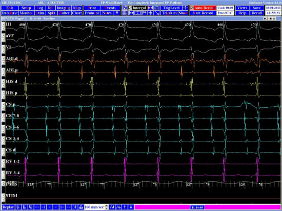 Case 8.1 fig 2C