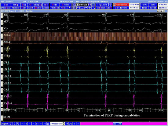 Case 8.1 fig 2D