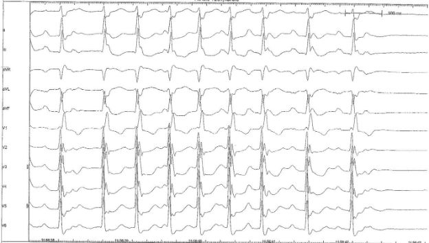 Vogt_InteractiveCase1_Fig1
