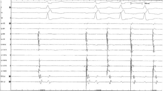 Vogt_InteractiveCase1_Fig2