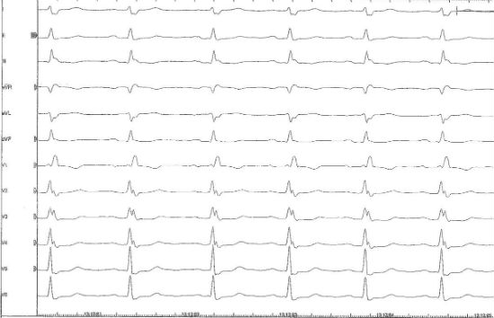 Vogt_InteractiveCase1_Fig3