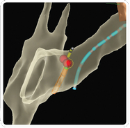 The Practice of Catheter Cryoablation for Cardiac Arrhythmias